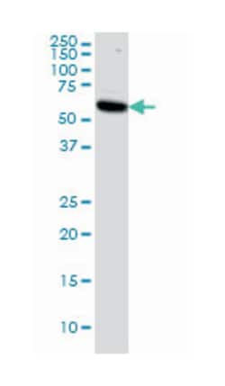 v-akt murine thymoma viral oncogene homolog 1, Mouse, Clone: 2E11, Abnova
