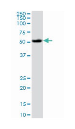 v-akt murine thymoma viral oncogene homolog 1, Mouse, Clone: 2E11, Abnova