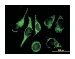 hydroxysteroid (17-beta) dehydrogenase 10, Mouse, Polyclonal Antibody,