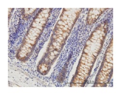 hydroxyacyl-Coenzyme A dehydrogenase, Mouse, Clone: 4B5, Abnova&trade;