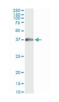 hydroxyacyl-Coenzyme A dehydrogenase, Mouse, Clone: 4B5, Abnova&trade;