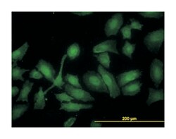 hydroxyacyl-Coenzyme A dehydrogenase, Mouse, Clone: 4B5, Abnova&trade;