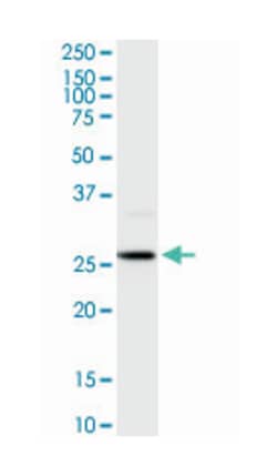 homeobox B9, Rabbit, Purified MaxPab Polyclonal Antibody, Abnova 100&mu;g;
