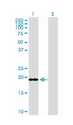 immature colon carcinoma transcript 1, Rabbit, Purified MaxPab Polyclonal Antibody, Abnova 100 &mu;g | Buy Online | Abnova | Fisher Scientific