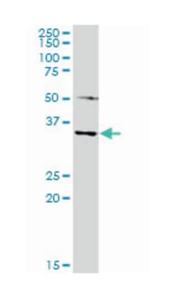 melanoma antigen family A, 4, Rabbit, Purified MaxPab Polyclonal Antibody, Abnova 100 &mu;g | Buy Online | Abnova | Fisher Scientific