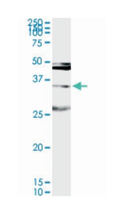 melanoma antigen family A, 9, Rabbit, Purified MaxPab Polyclonal Antibody,