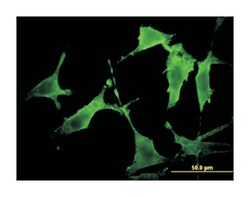 p21 protein (Cdc42/Rac)-activated kinase 3, Mouse, Clone: 1H7, Abnova 100&mu;g;