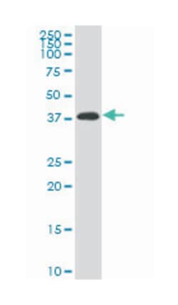 paired-like homeodomain 2, Mouse, Clone: 3D2, Abnova 100&mu;g; Unlabeled:Antibodies,
