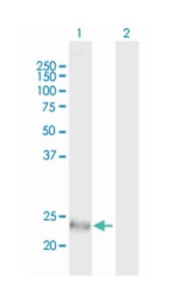 SFRS2, Mouse, Polyclonal Antibody, Abnova 50&mu;g; Unlabeled:Antibodies,
