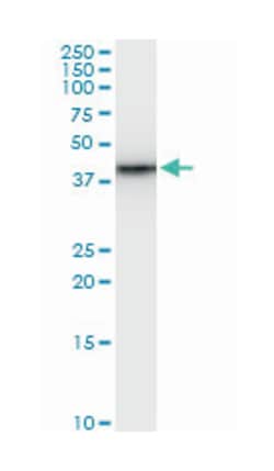 SWI/SNF related, matrix associated, actin dependent regulator of chromatin,