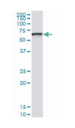 SWI/SNF related, matrix associated, actin dependent regulator of chromatin,