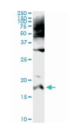 serine peptidase inhibitor, Kazal type 1, Mouse, Clone: 4D4, Abnova 100&mu;g;