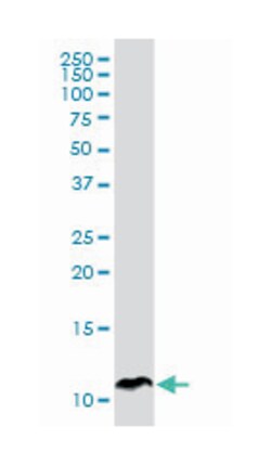 SPINK1, Mouse, Clone: 4D4, Abnova 200&mu;L; Unlabeled:Antibodies, Monoclonal