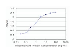 TAF7 RNA polymerase II, TATA box binding protein (TBP)-associated factor,
