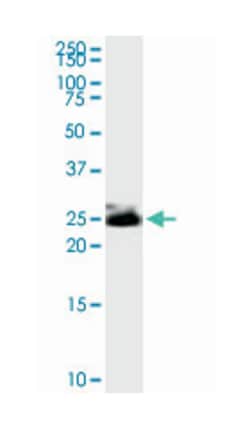 Thy-1 cell surface antigen, Mouse, Clone: 3F9, Abnova&trade;