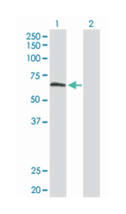 tubby like protein 2, Rabbit, Purified MaxPab Polyclonal Antibody, Abnova 100 &mu;g | Buy Online | Abnova | Fisher Scientific