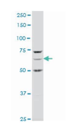 A kinase (PRKA) anchor protein 1 (A01), Mouse anti-Human, Polyclonal Antibody,