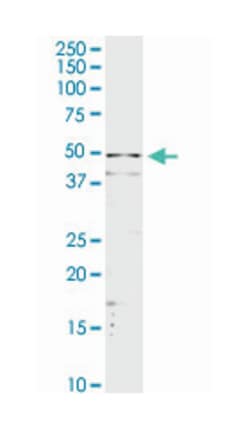 serpin peptidase inhibitor, clade A (alpha-1 antiproteinase, antitrypsin),