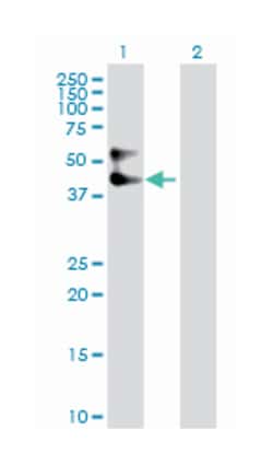 serpin peptidase inhibitor, clade A (alpha-1 antiproteinase, antitrypsin),