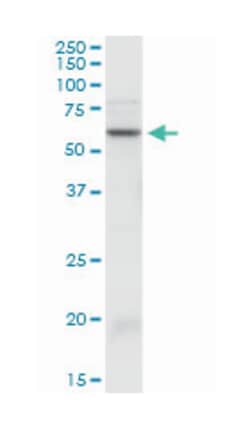 serpin peptidase inhibitor, clade A (alpha-1 antiproteinase, antitrypsin),