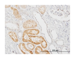 SERPINA3, Mouse, Clone: 1C10, Abnova 100&mu;g; Unlabeled:Antibodies, Monoclonal