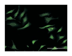 SERPINA3, Mouse, Clone: 1C10, Abnova 100&mu;g; Unlabeled:Antibodies, Monoclonal