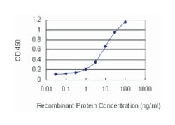 Abnova Corporation&nbsp;AAM, Mouse, Clone: 2H2, Abnova&trade;