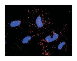 ABL2, Mouse, Clone: 6D5, Abnova 100&mu;g; Unlabeled:Antibodies, Monoclonal