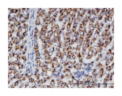 ACAA1, Mouse, Clone: 3F11, Abnova 100&mu;g; Unlabeled:Antibodies, Monoclonal