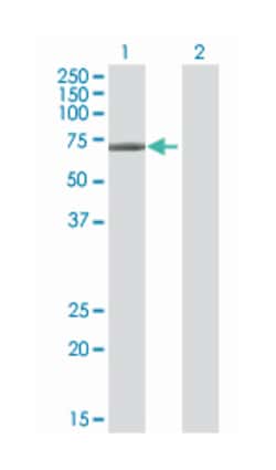 acetylcholinesterase (Yt blood group), Mouse, Polyclonal Antibody, Abnova