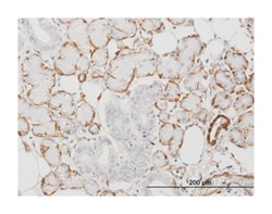 actin, alpha 2, smooth muscle, aorta, Mouse, Clone: 1D11-2B9, Abnova™