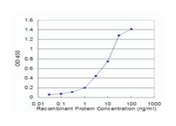 actin, alpha 2, smooth muscle, aorta, Mouse, Clone: 1D11-2B9, Abnova&trade;