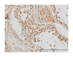 ACTN4 (M01), Mouse anti-Human, Mouse, Rat, Clone: 4D10, Abnova&trade;