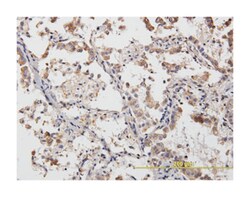 ACTN4 (M01), Mouse anti-Human, Mouse, Rat, Clone: 4D10, Abnova&trade;