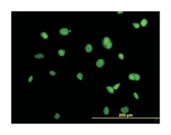 ACTN4 (M01), Mouse anti-Human, Mouse, Rat, Clone: 4D10, Abnova&trade;