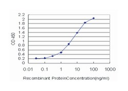 ACTN4 (M01), Mouse anti-Human, Mouse, Rat, Clone: 4D10, Abnova&trade;