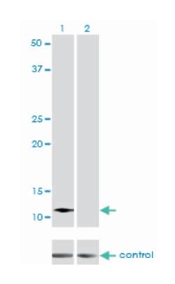 ACYP2, Mouse, Clone: 2H7, Abnova 100 &mu;g | Buy Online | Abnova Corporation | Fisher Scientific
