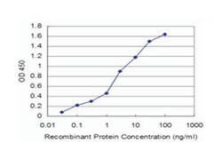 ACYP2, Mouse, Clone: 2H7, Abnova 100 &mu;g | Buy Online | Abnova Corporation | Fisher Scientific