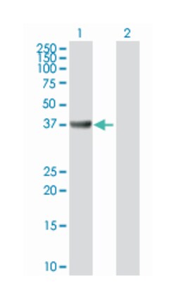 adenosine deaminase, Rabbit, Purified MaxPab Polyclonal Antibody, Abnova 100 &mu;g | Buy Online | Abnova | Fisher Scientific
