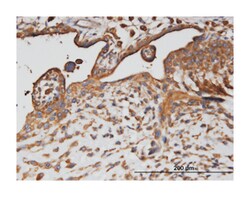 AP2B1, Mouse, Clone: 2D5, Abnova 100&mu;g; Unlabeled:Antibodies, Monoclonal