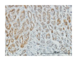 AEBP1, Mouse, Clone: 1D2, Abnova 100&mu;g; Unlabeled:Antibodies, Monoclonal