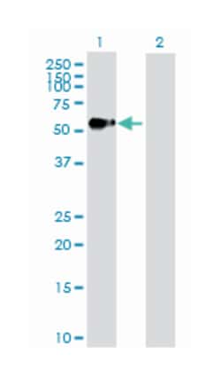 advanced glycosylation end product-specific receptor, Rabbit, Purified MaxPab&trade; Polyclonal Antibody, Abnova&trade;