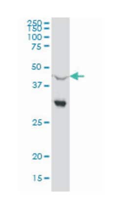 nuclear receptor subfamily 0, group B, member 1, Mouse, Clone: 1F10, Abnova