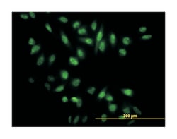 nuclear receptor subfamily 0, group B, member 1, Mouse, Clone: 1F10, Abnova