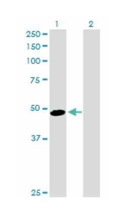 alpha-2-HS-glycoprotein, Rabbit, Purified MaxPab Polyclonal Antibody, Abnova