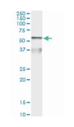 AHSG, Mouse, Clone: 1D8, Abnova 100&mu;g; Unlabeled:Antibodies, Monoclonal