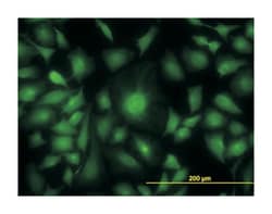 adenylate kinase 1, Mouse, Clone: M1, Abnova&trade;