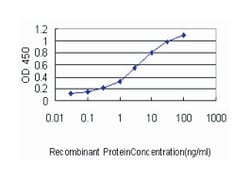 adenylate kinase 1, Mouse, Clone: M1, Abnova&trade;