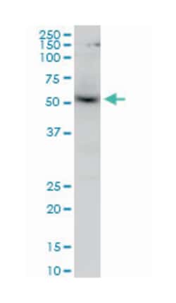 v-akt murine thymoma viral oncogene homolog 1, Mouse, Clone: 2E11, Abnova