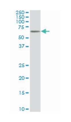 v-akt murine thymoma viral oncogene homolog 1, Mouse, Clone: 2E11, Abnova